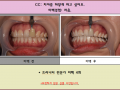 치아를 하얗게 하는 미백치료. 트리니티 미백 하루2시간이면 가능합니다^^