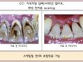 담배로인한 니코틴 제거 전/후사진입니다.