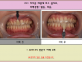 치아미백 전/후 사진입니다^^7